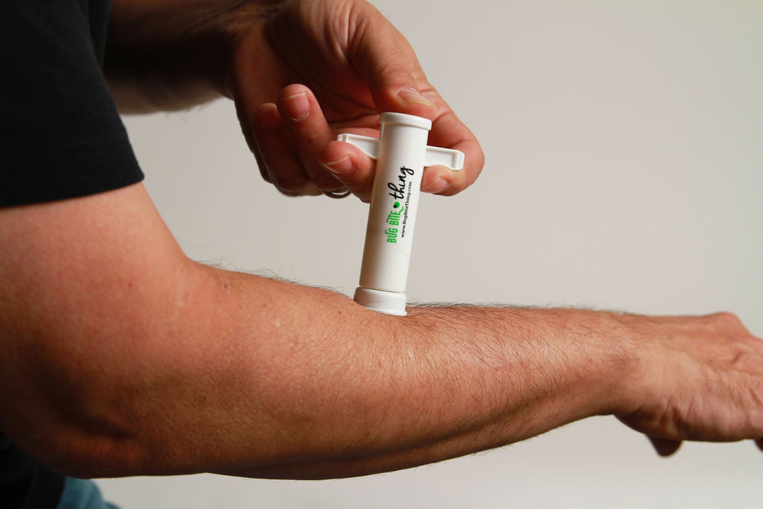 7 Reasons why you need a Bug Bite Thing®